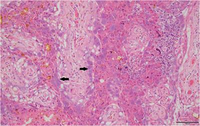 An Old Pathogen in a New Environment–Implications of Coxiella burnetii in Australian Fur Seals (Arctocephalus pusillus doriferus)